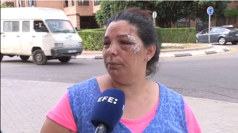 La mujer atropellada en Beteró ya ha sido dada de alta. /EPDA